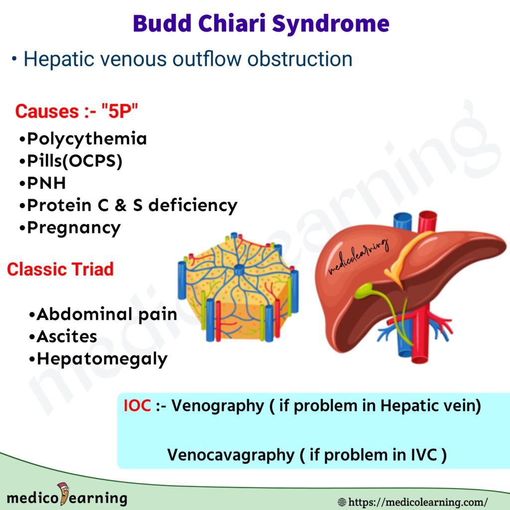 Budd Chiari Syndrome Flash Card