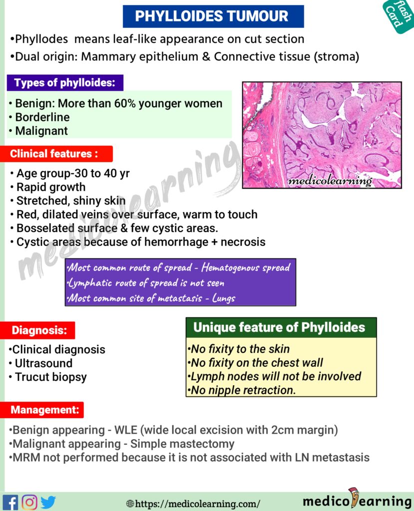 Phylloides Tumours Flash Card