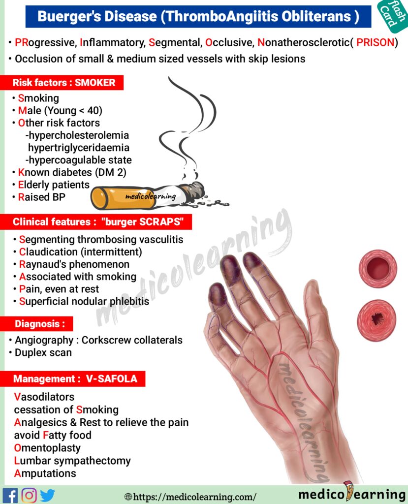 Buerger's disease ( Thromboangiitis obliterans) Flash Card