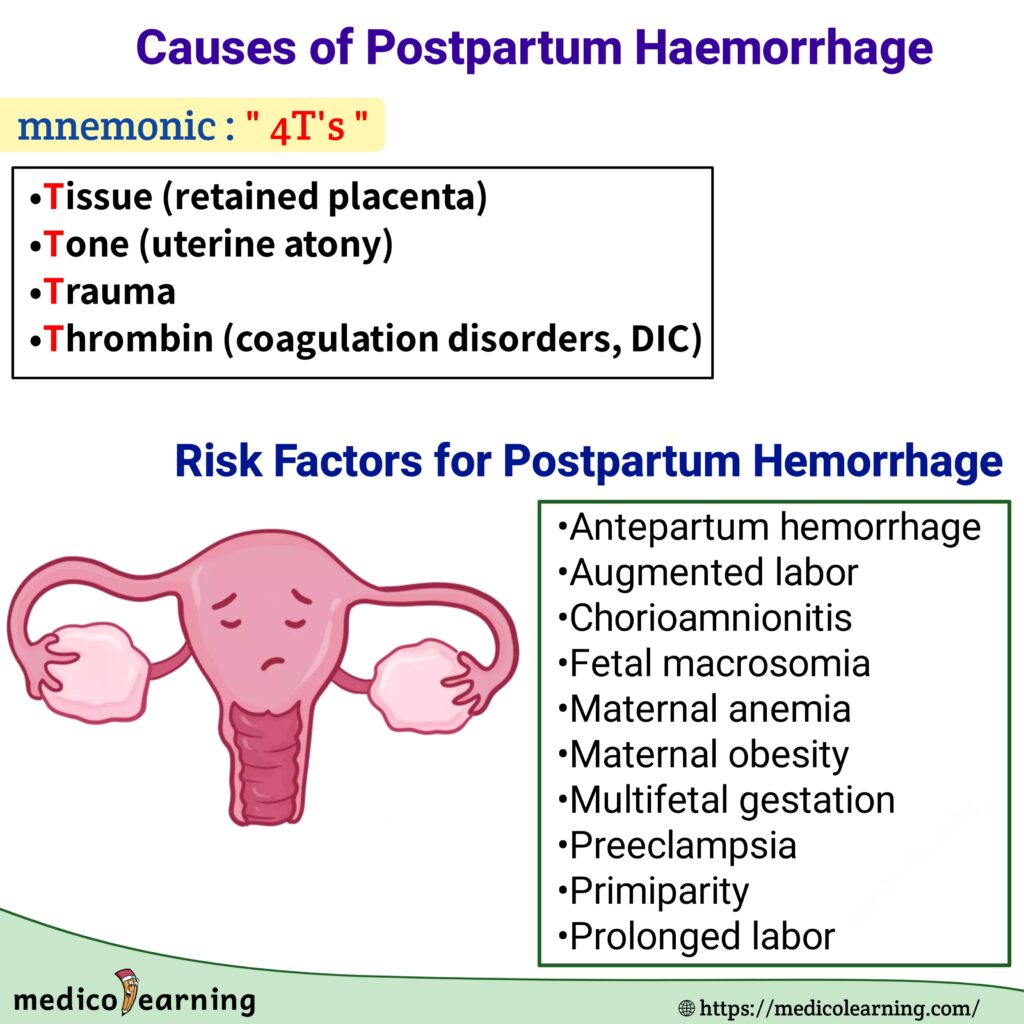 Causes Of Postpartum Hemorrhage MedicoLearning