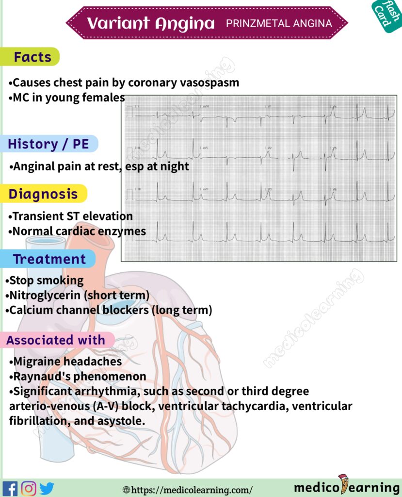 Variant angina