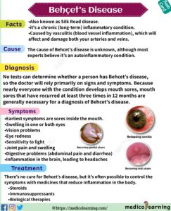 Read more about the article Behcet’s Disease