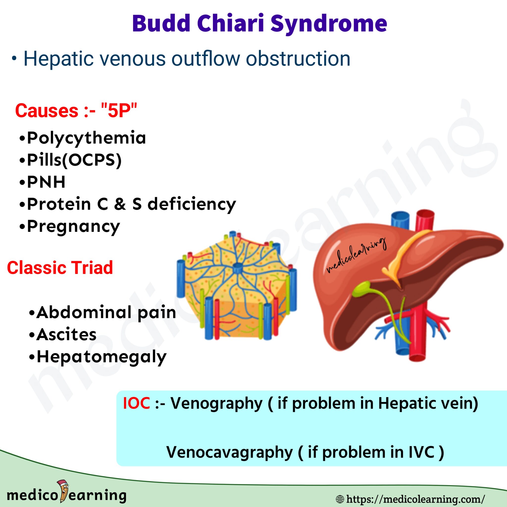 Budd Chiari Syndrome – MedicoLearning