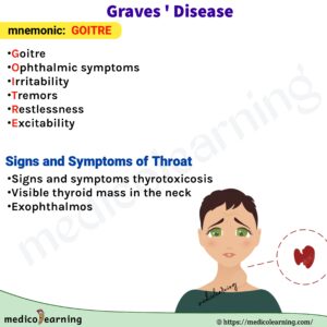 Read more about the article Grave’s Disease