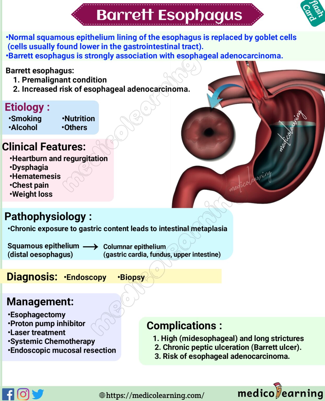 Barrett Esophagus MedicoLearning