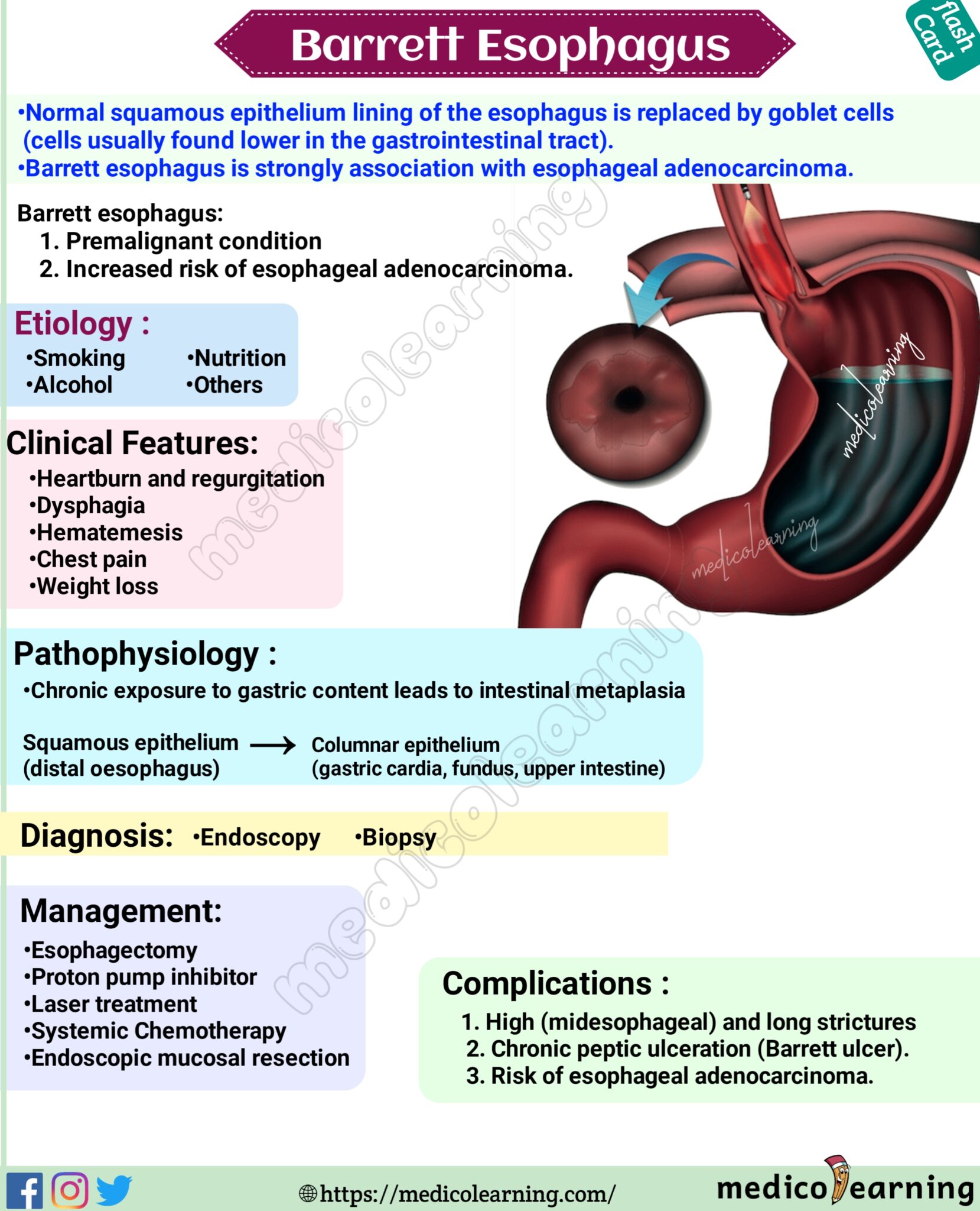 Barrett Esophagus Medicolearning 3316