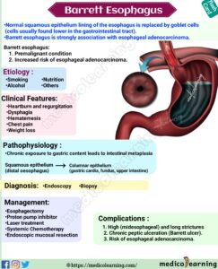 Read more about the article Barrett Esophagus