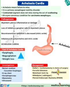 Read more about the article Achalasia Cardia