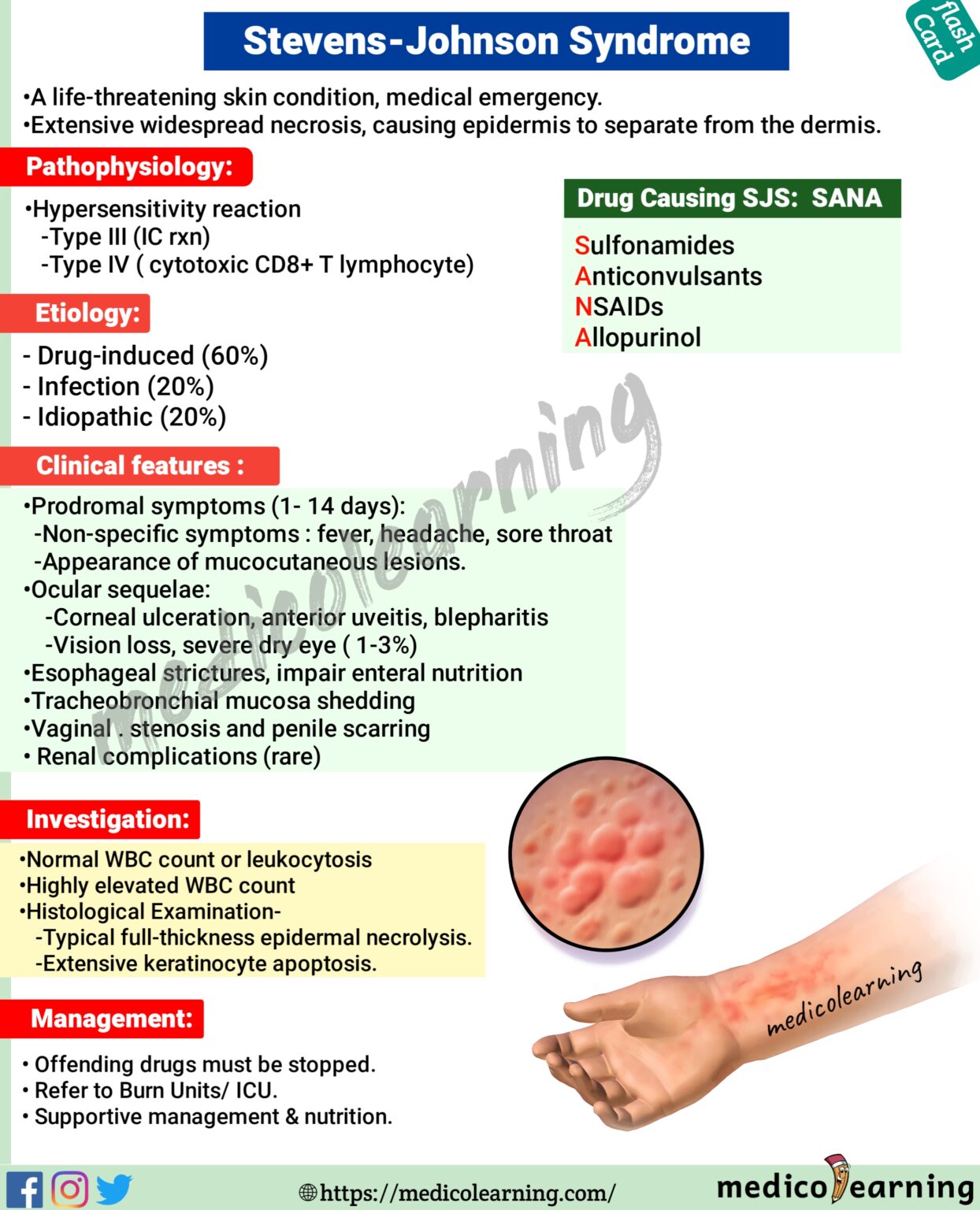 Stevens Johnson Syndrome – MedicoLearning