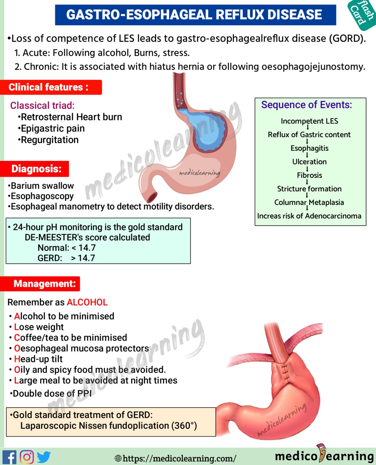 Gastroesophageal Reflux Disease GERD MedicoLearning