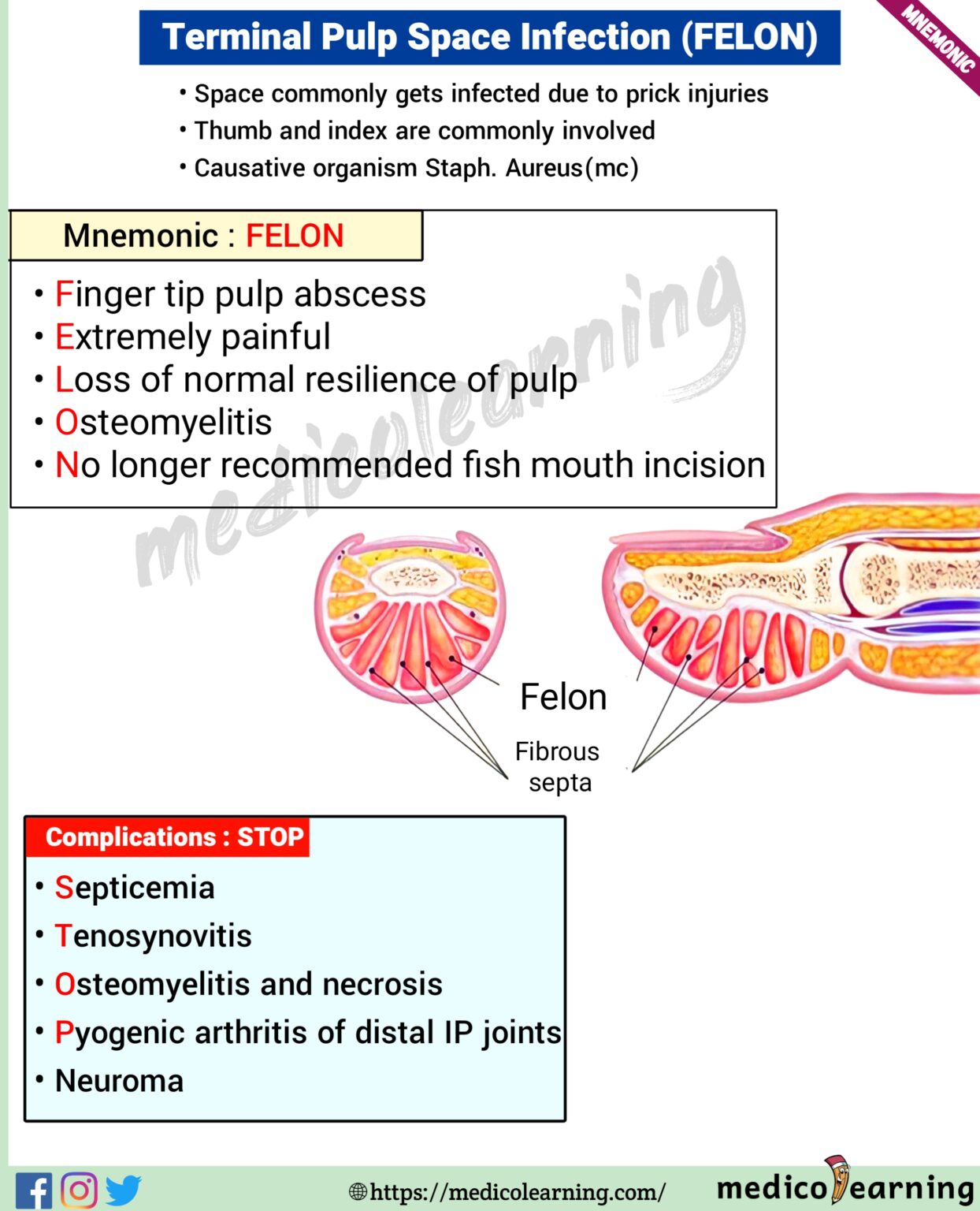 Felon (Terminal Pulp Space Infection) MedicoLearning