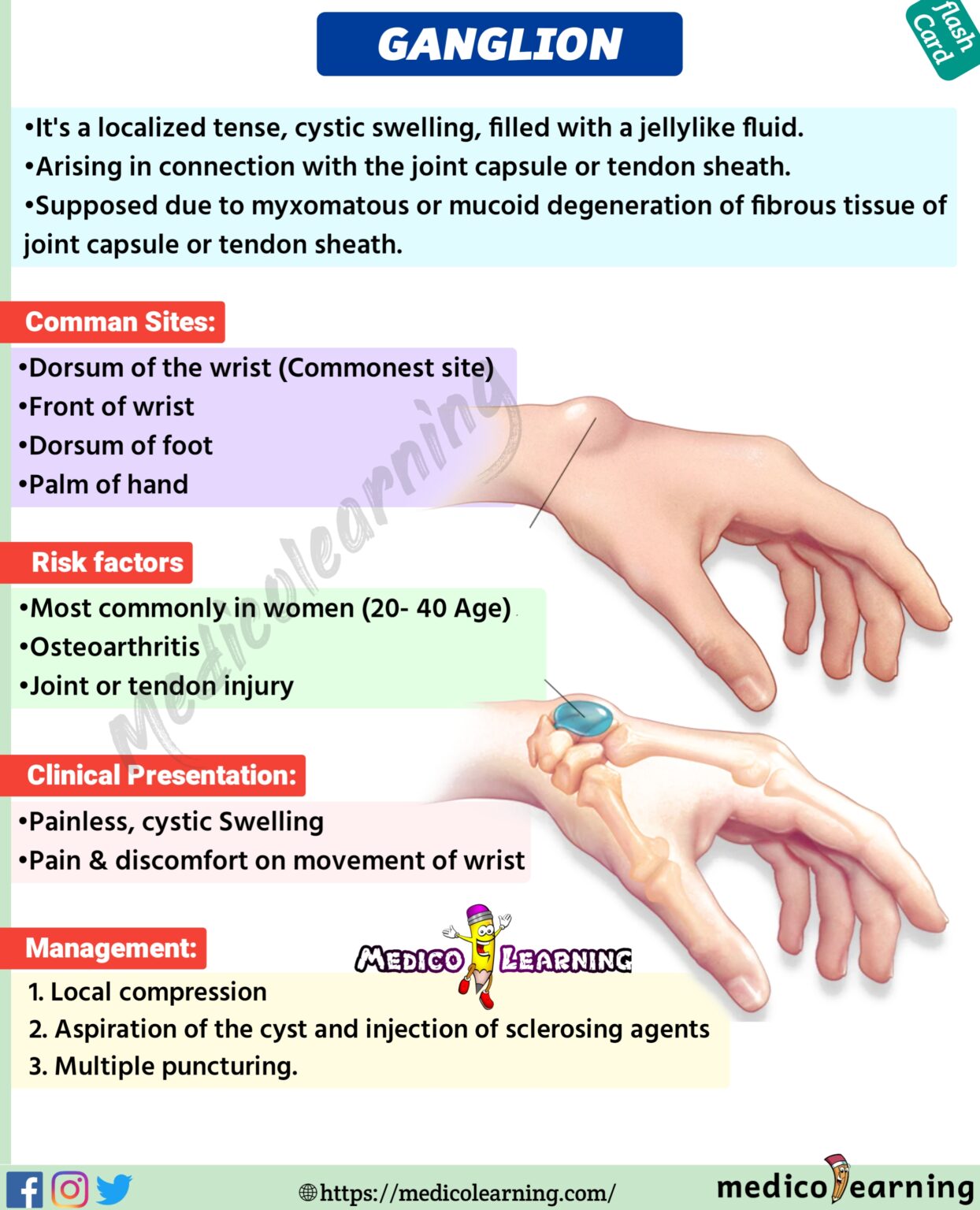 Cubitus varus (gunstock deformity) MedicoLearning