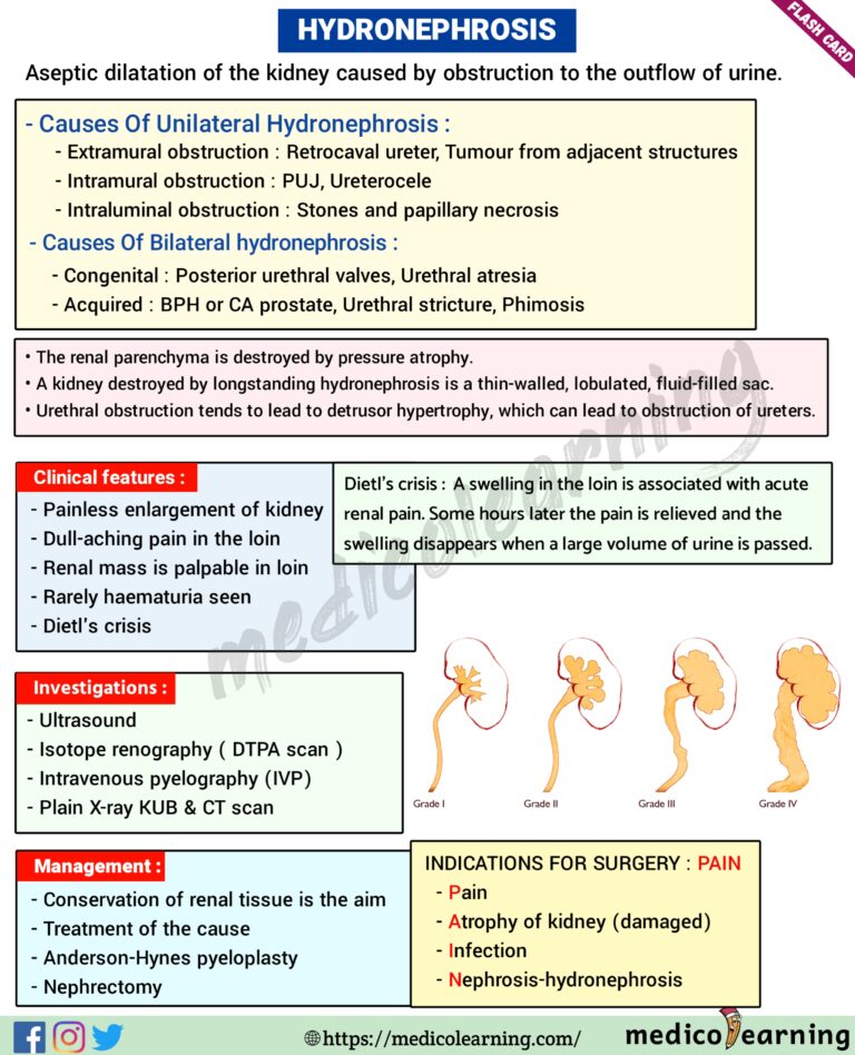 Hydronephrosis Wikidoc