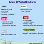 Read more about the article Vaginal Discharge