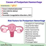 Read more about the article Causes of Postpartum Hemorrhage