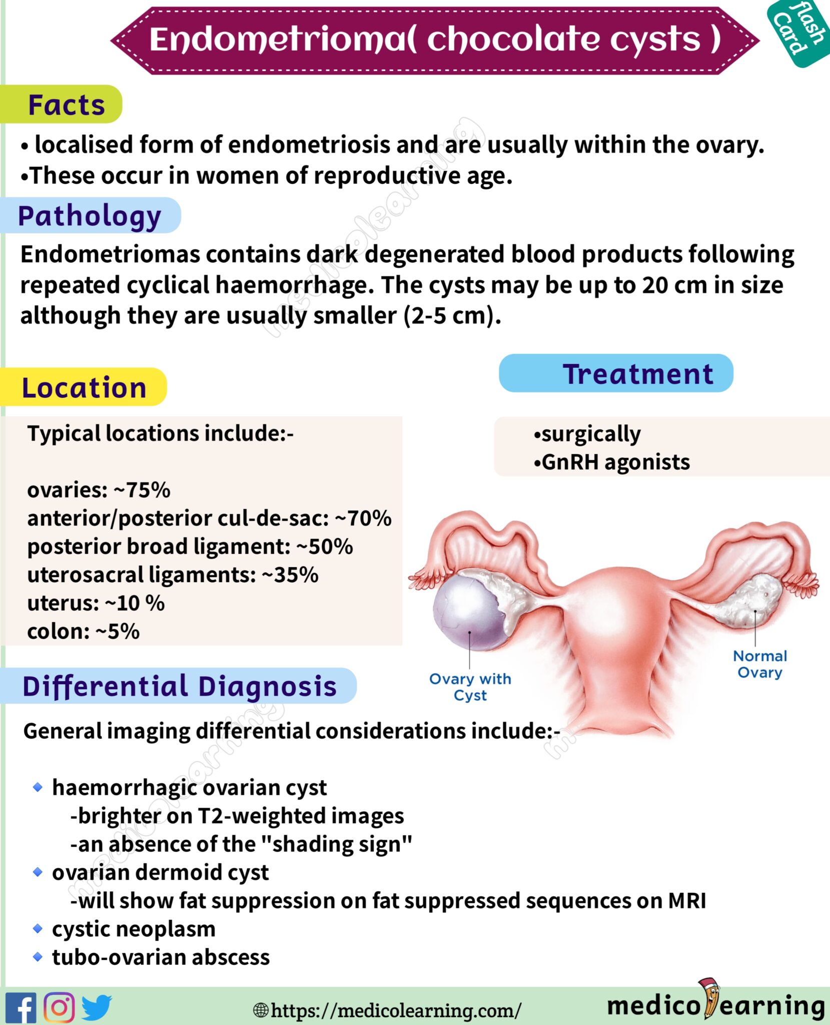 Chocolate Cyst Ovarian Endometrioma Medicolearning 7762