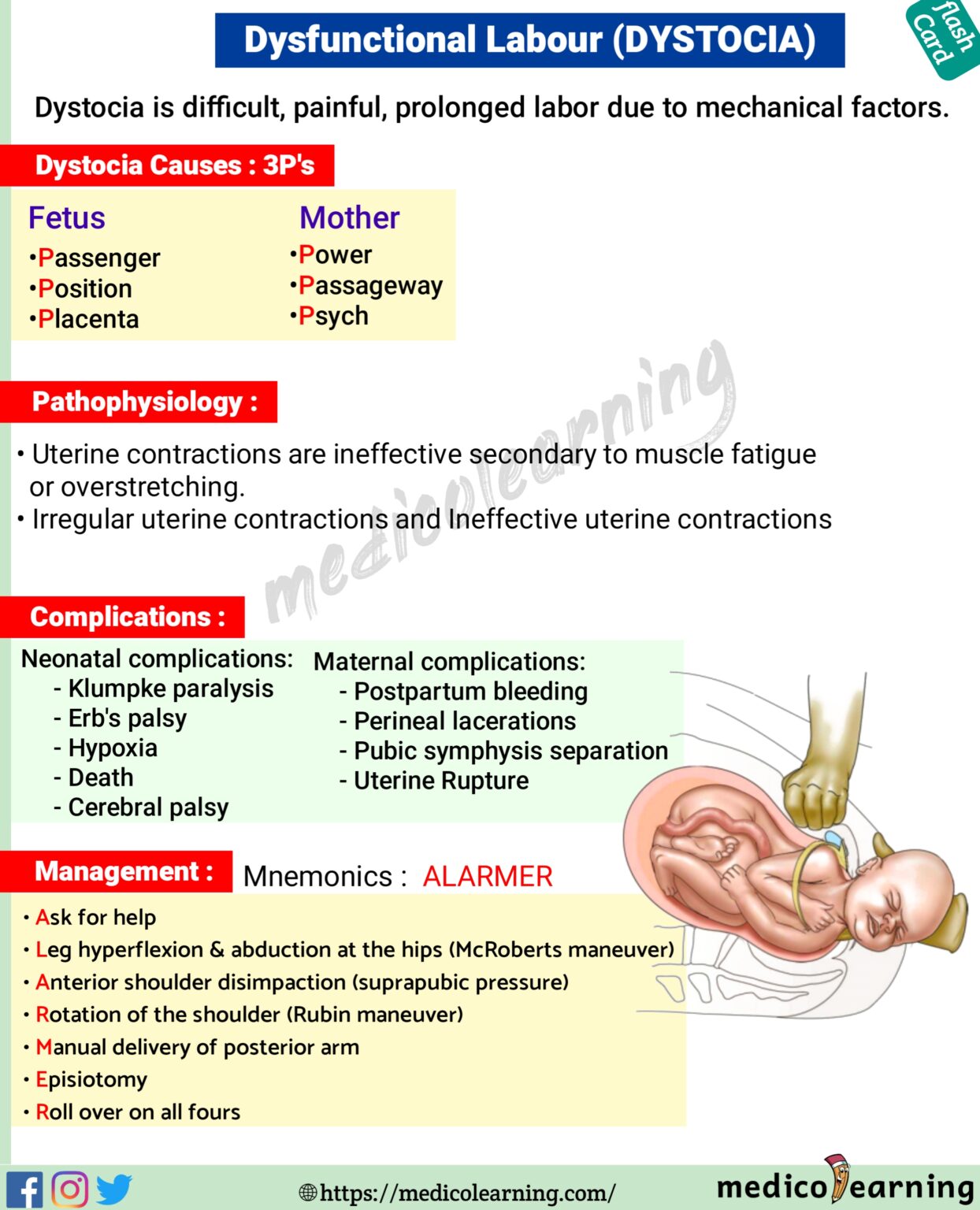 Cubitus varus (gunstock deformity) MedicoLearning