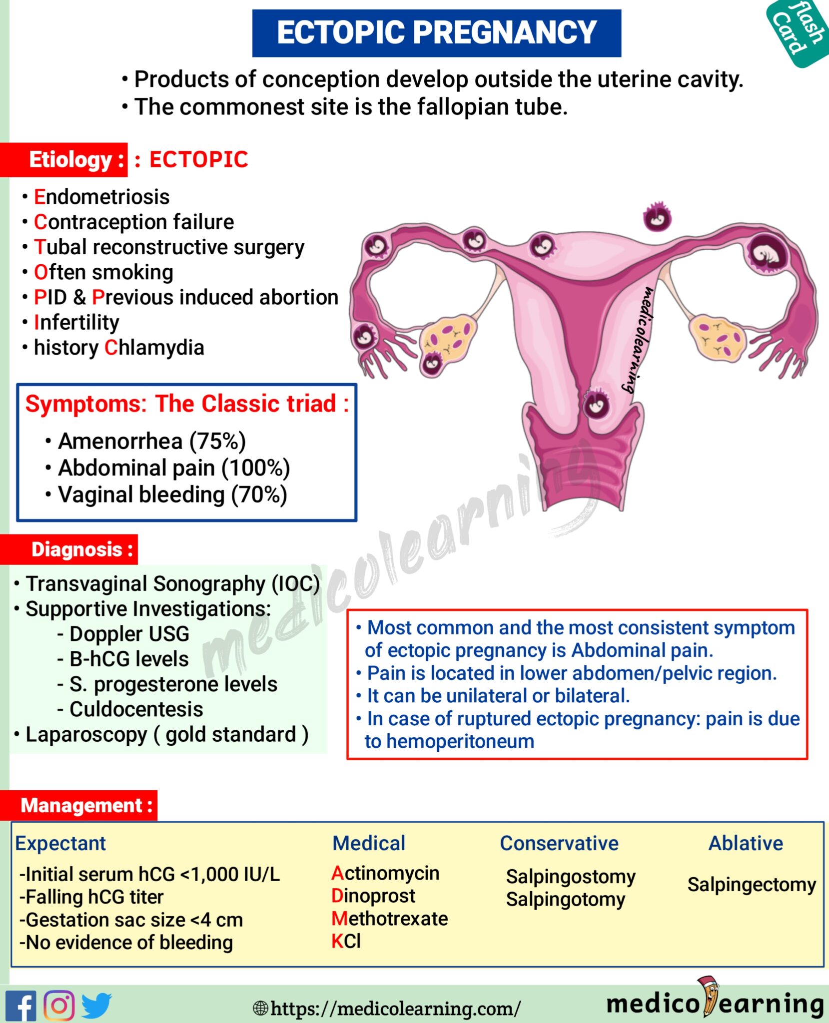 Ectopic Pregnancy – MedicoLearning