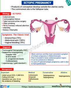 Read more about the article Ectopic Pregnancy