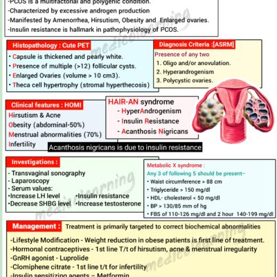 Polycystic ovary syndrome (PCOD) – MedicoLearning