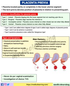 Read more about the article Placenta Previa