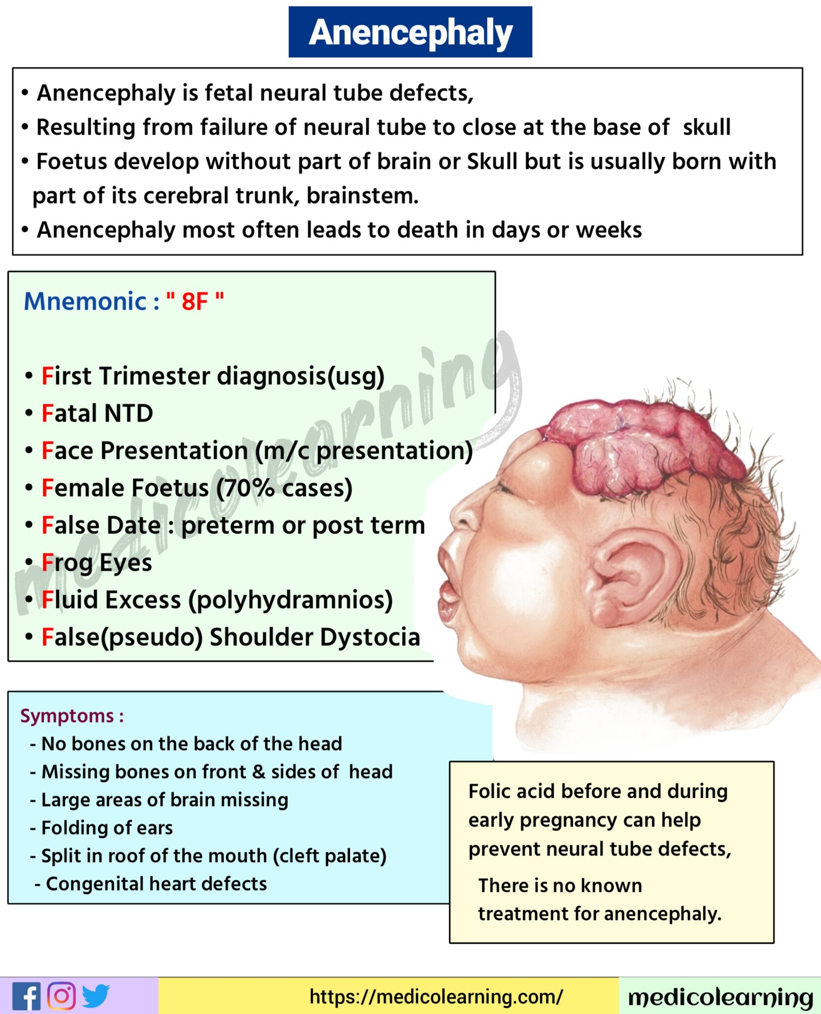 Anencephaly Medicolearning