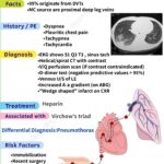 Read more about the article Pulmonary embolism