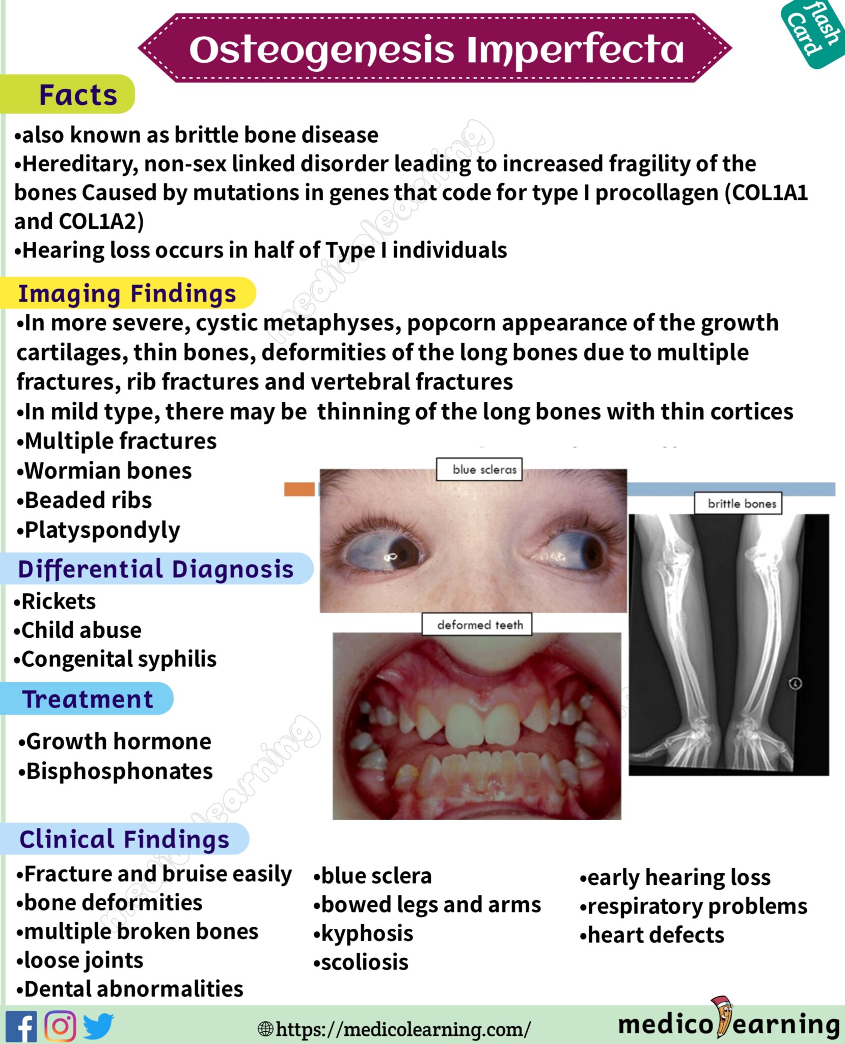 Osteogenesis Imperfecta Medicolearning 0321