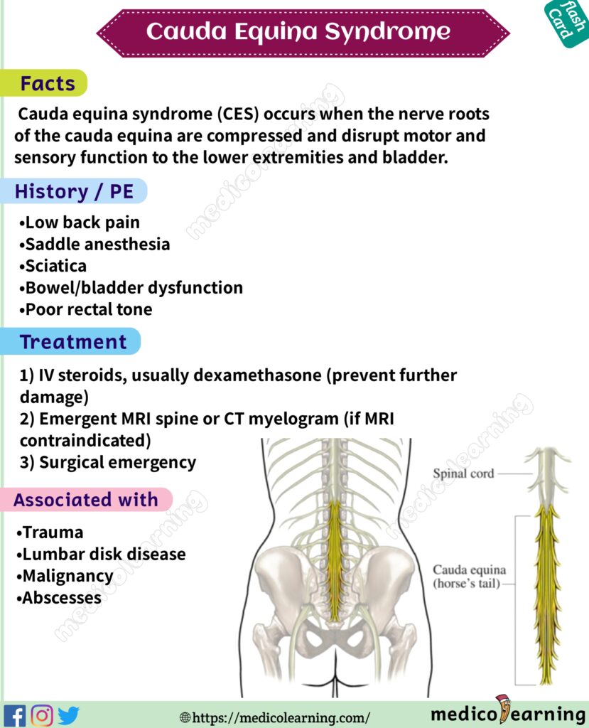 Symptoms Of Cauda Equina Syndrome But No Firm Diagnosis Cauda Equina ...