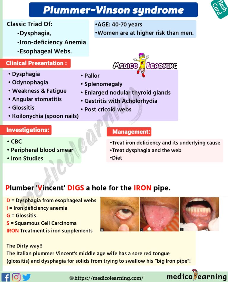 Plummer-Vinson syndrome – MedicoLearning