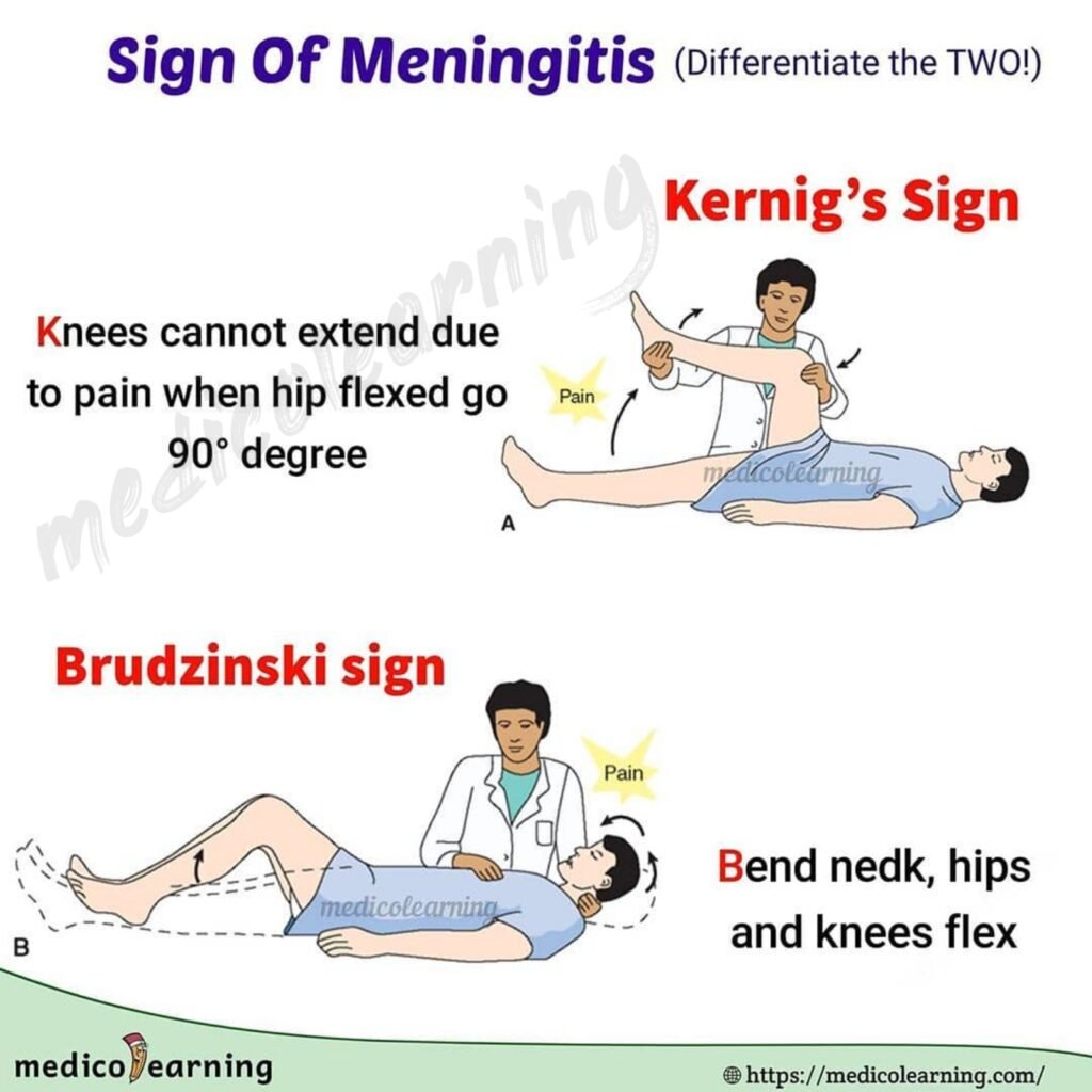Meningitis MedicoLearning