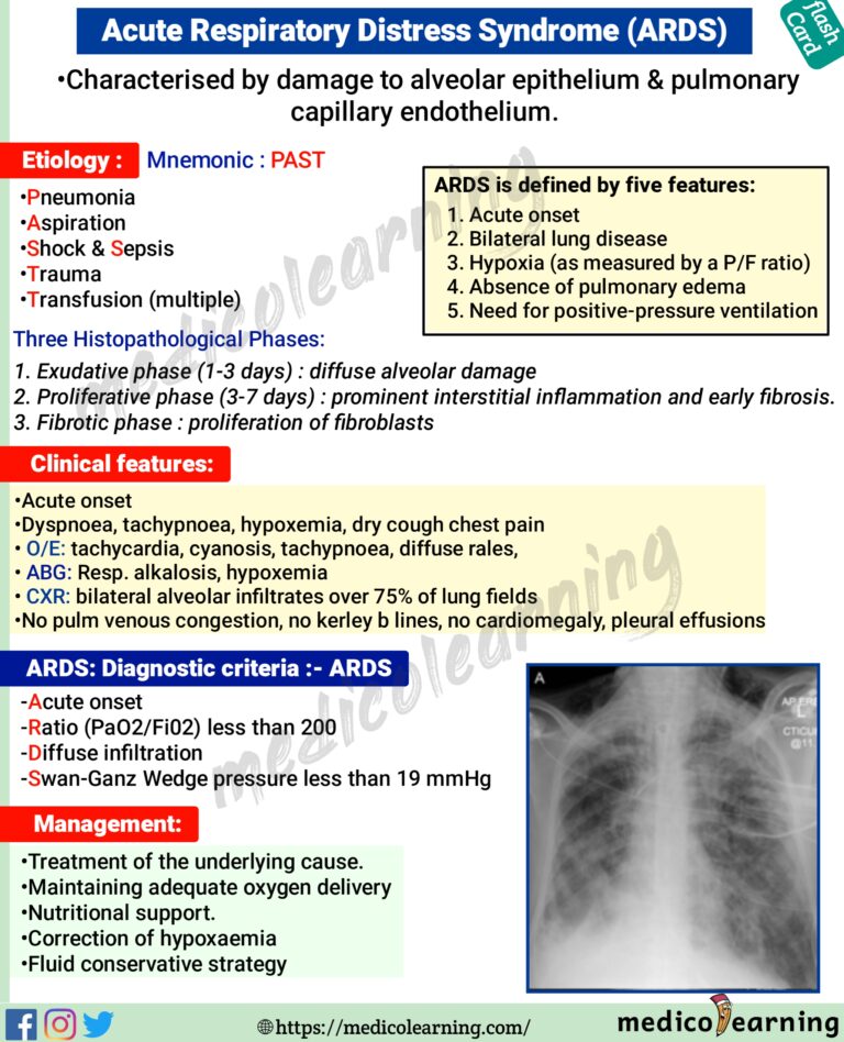 Acute Respiratory Distress Syndrome (ARDS) – MedicoLearning