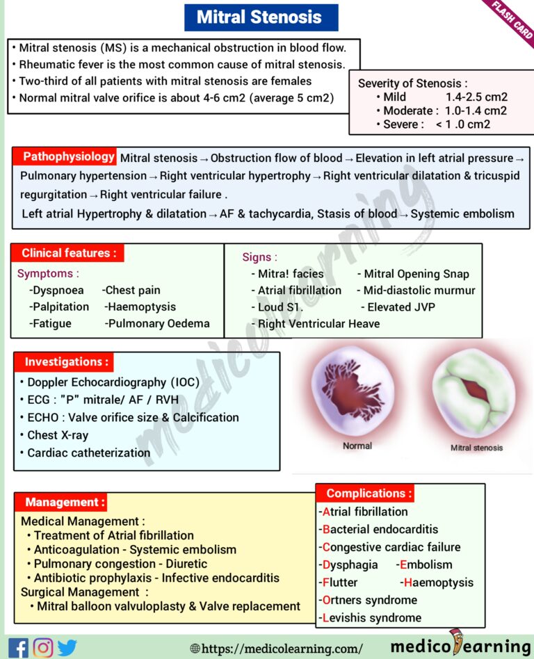 Mitral Stenosis – MedicoLearning