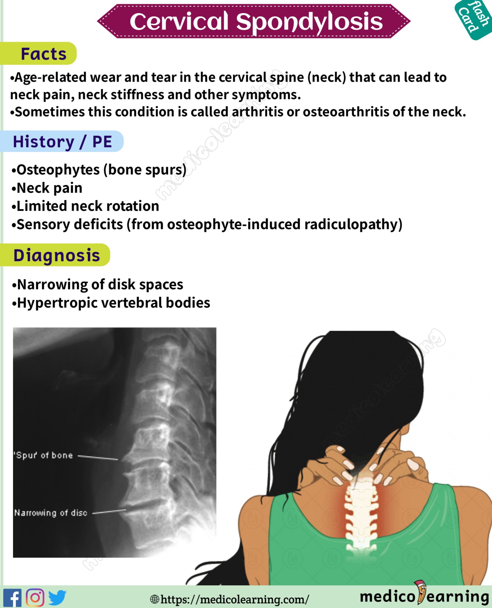 Cervical Spondylosis Medicolearning