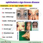 Read more about the article Ophthalmic Sign in Graves disease