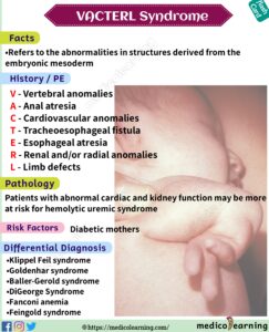 Read more about the article vacteral Syndrome