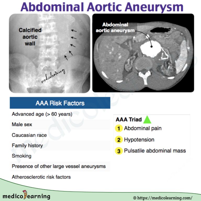 Potter Syndrome MedicoLearning