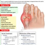 Read more about the article Gout