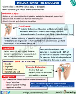 Read more about the article Dislocation Of Shoulder