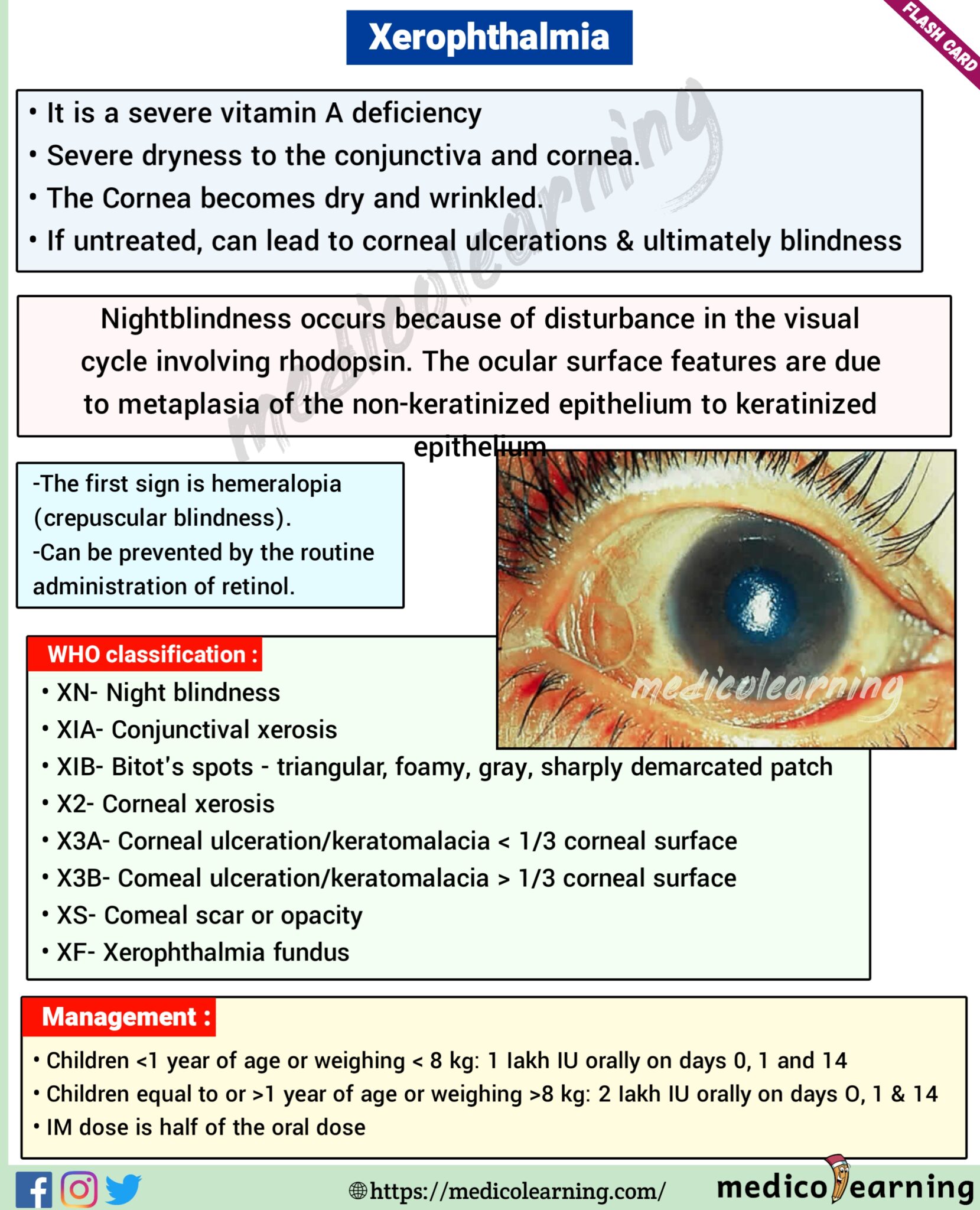 Xerophthalmia – MedicoLearning