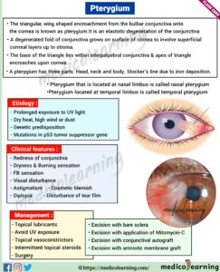 Read more about the article Pterygium