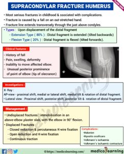 Read more about the article Supracondylar Fracture Of Humerus