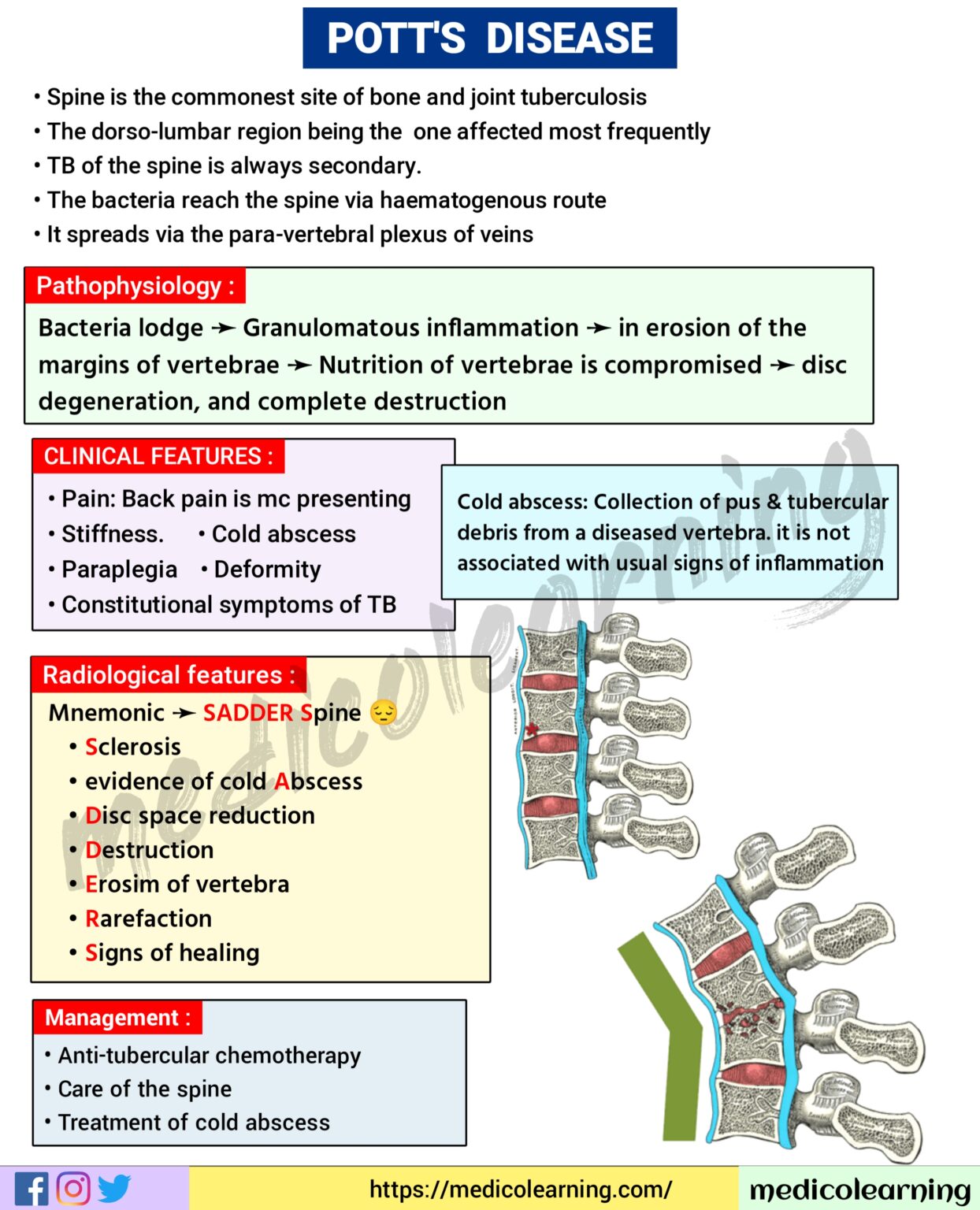 Pott’s spine MedicoLearning