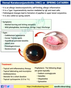 Read more about the article Vernal Keratoconjunctivitis (VKC), ( Spring Catarrh )